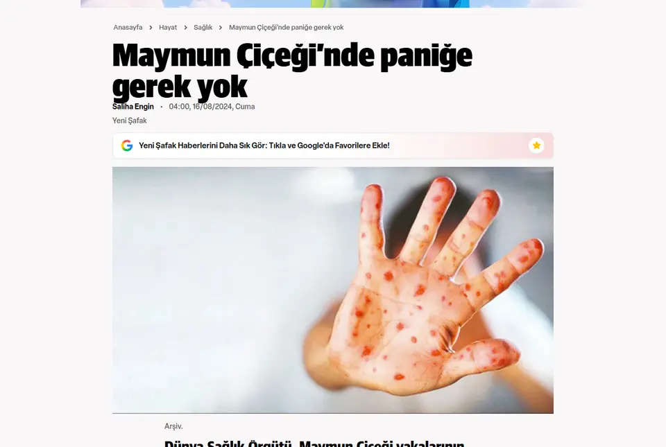 Yeni Şafak haberi ekran görüntüsü: Maymun Çiçeği'nde paniğe gerek yok